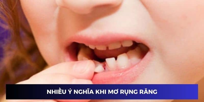 Chiêm bao rụng răng chứa đựng nhiều ý nghĩa